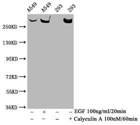 TOR/mTOR [p Ser2481] Antibody (3H11)