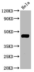 MEK1 [p Thr292] Antibody (4E7)