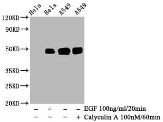 c-jun [p Ser63] Antibody (4A11)