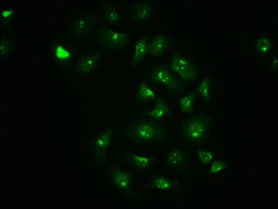 c-jun [p Ser63] Antibody (4A11)