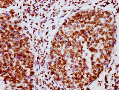 Jak2 [p Tyr1007, p Tyr1008] Antibody (1A4)