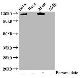 Jak2 [p Tyr1007, p Tyr1008] Antibody (1A4)