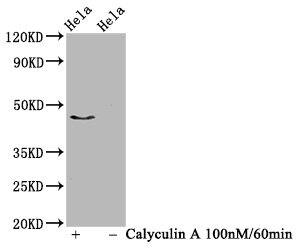 IRF3 [p Ser386] Antibody (4H10)