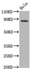 HSF1 [p Ser326] Antibody (2A7)