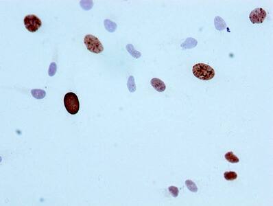 Histone H3.1 [p Ser10] Antibody (2A5)