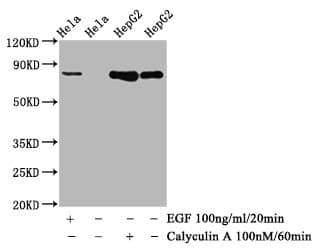 Glycogen Synthase [p Ser641] Antibody (1D1)