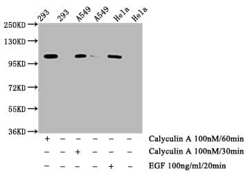 IRE1 alpha [p Ser724] Antibody (1F12)