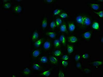 IRE1 alpha [p Ser724] Antibody (1F12)