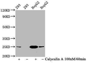 eIF4E [p Ser209] Antibody (1F3)