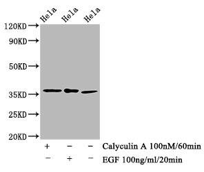 eIF2 alpha/EIF2S1 [p Ser51] Antibody (1C6)