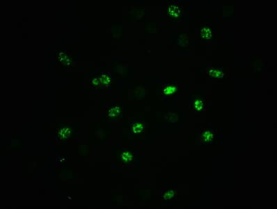 eIF2 alpha/EIF2S1 [p Ser51] Antibody (1C6)