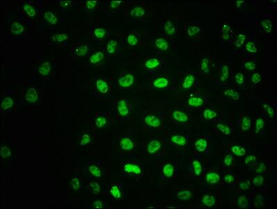 ATM [p Ser1981] Antibody (1C5)