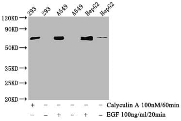 ATF2 [p Thr71] Antibody (4F2)