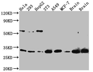 PGAM1 Antibody (9A5)