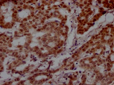 PARP Antibody (7C11)