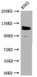 PARP Antibody (7C11)