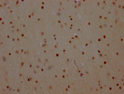 PARP Antibody (8C7)