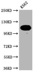 PARP Antibody (8C7)