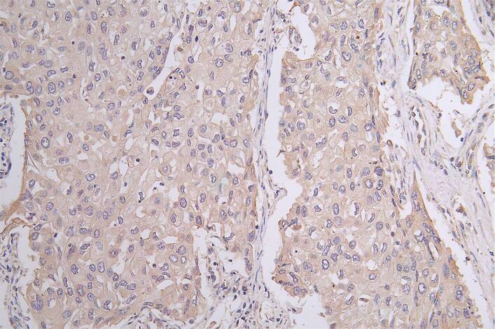 Pannexin-1 Antibody (28G5)