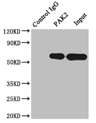 PAK2 Antibody (6D12)