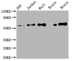 PAK2 Antibody (6D12)