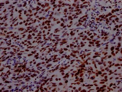 PABPN1 Antibody (6C3)