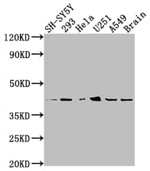 delta Opioid R/OPRD1 Antibody (7G7)