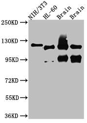 O-GlcNAc Transferase p110 subunit Antibody (8G7)