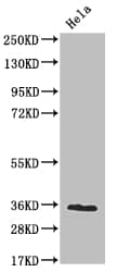 ADP-Sugar Pyrophosphatase/NUDT5 Antibody (10D2)