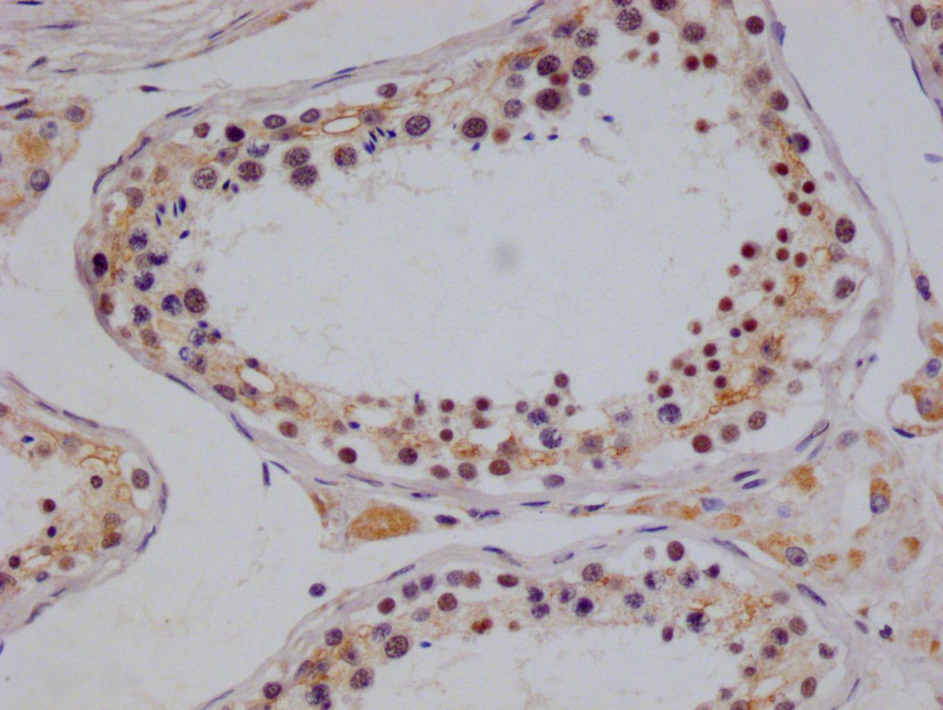 NTH1 Antibody (22H10)