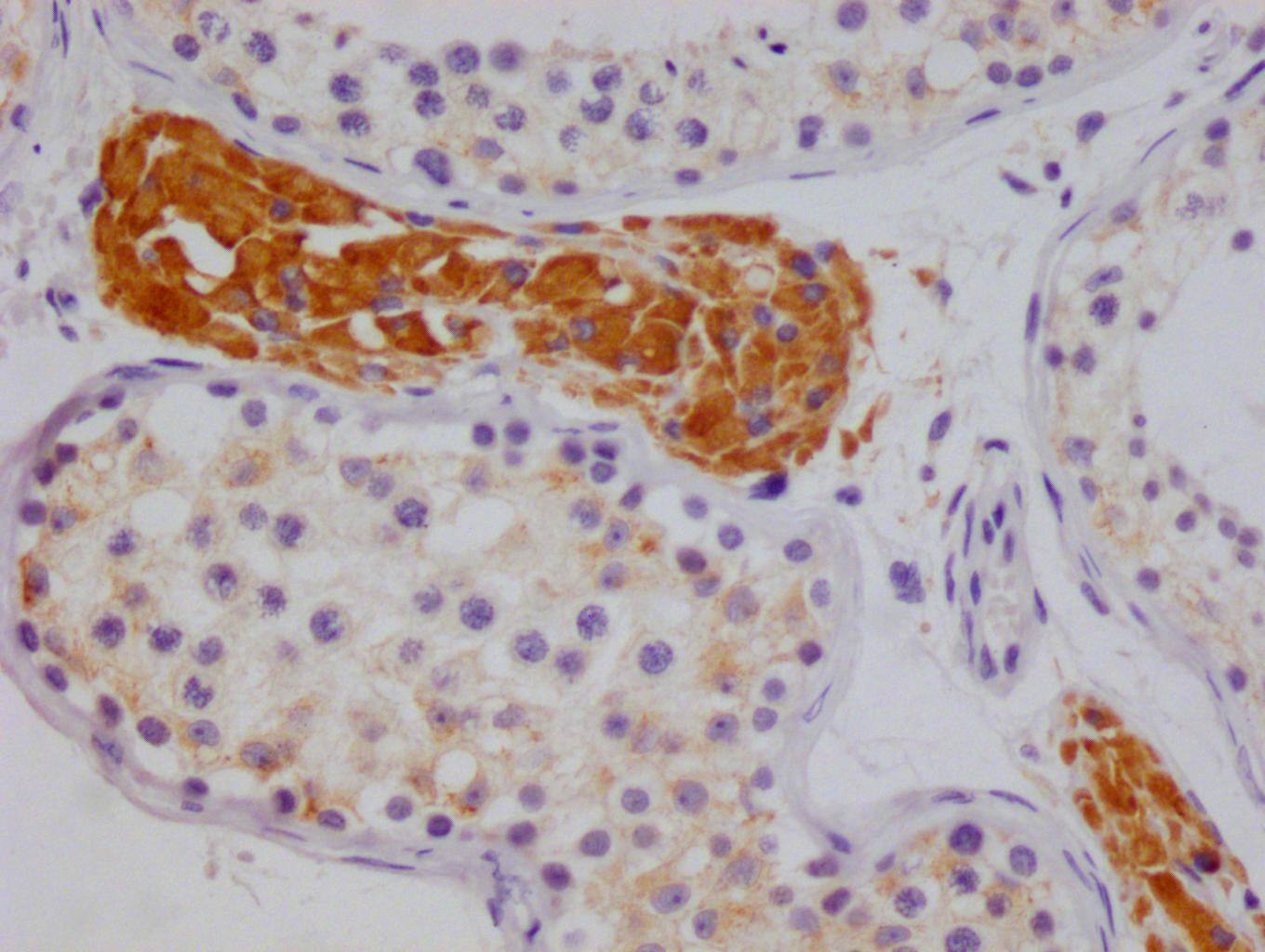 NSDHL Antibody (20F2)