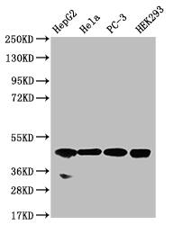 NSDHL Antibody (20F2)