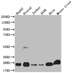 NQO-2 Antibody (8E12)