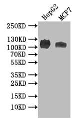 NPRB/NPR2 Antibody (19C7)