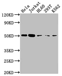 Caspase-2 Antibody (7E5)