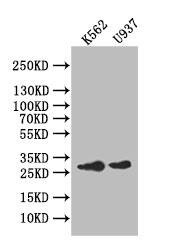 Carbonic Anhydrase I/CA1 Antibody (26E3)