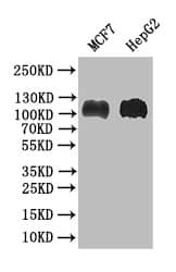 BRIP1/FANCJ Antibody (27F4)