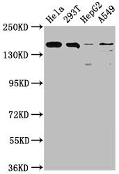 BRD4 Antibody (1E5)