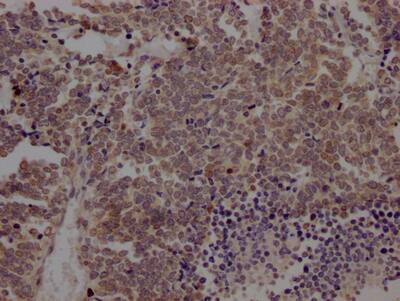 BMI-1 Antibody (1F2)