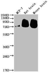 BACE-1 Antibody (7G3)