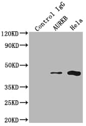 Aurora B Antibody (4E5)