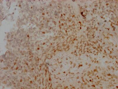 Aurora B Antibody (4E5)