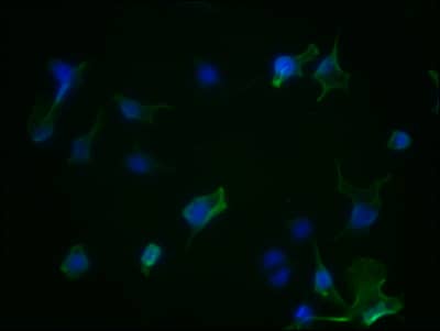 Aurora A Antibody (1H8)