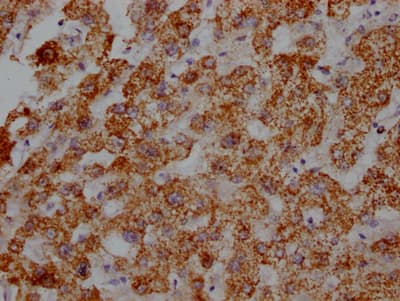 ATPB Antibody (5F10)