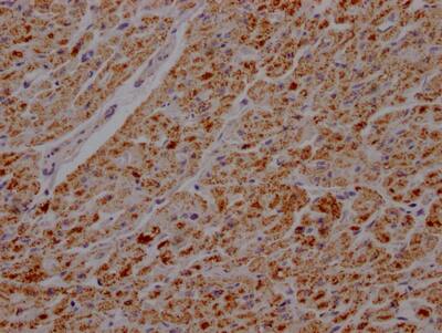 ATPB Antibody (5F10)