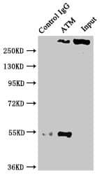 ATM Antibody (4E11)