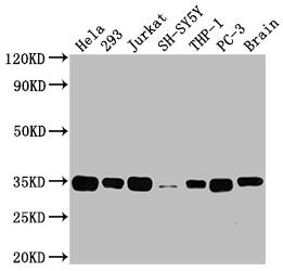 ATF5 Antibody (9D8)