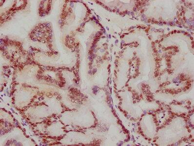 ATF2 Antibody (3D12)