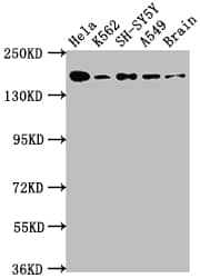 APC Antibody (5F2)