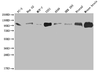 ALCAM/CD166 Antibody (21B9)